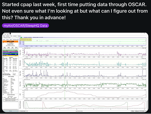 Reddit post about CPAP therapy struggles