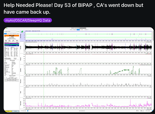 Reddit post: Help needed, BIPAP data