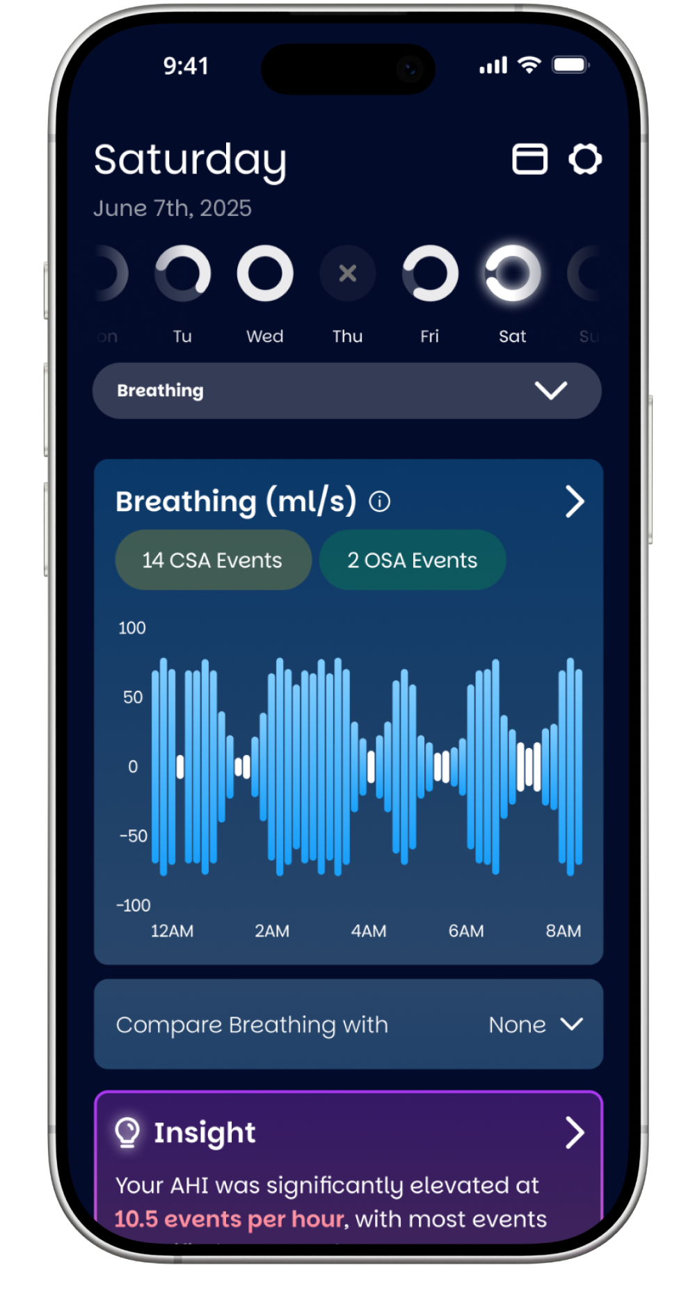 Single chart screen 1