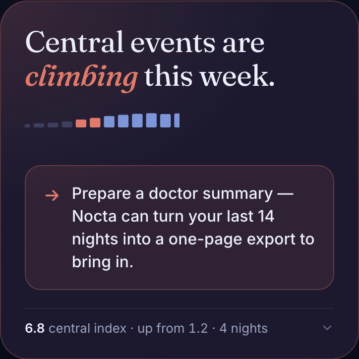 The Nocta why-card component