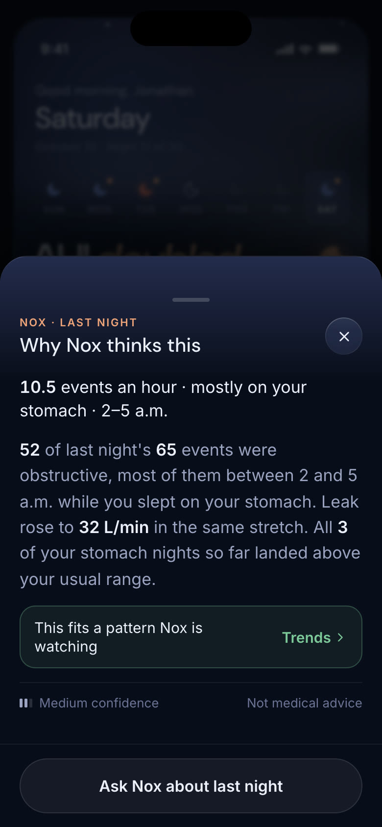 Final iteration — why Nox thinks this